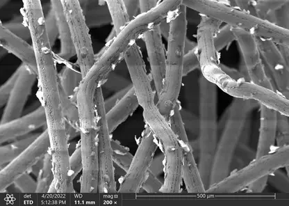 Ученые из ТГУ создали уникальные биоматериалы для людей с дефектами мягких тканей