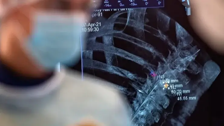 В Приморье создали нейросеть, которая поможет врачам выявлять рак легких